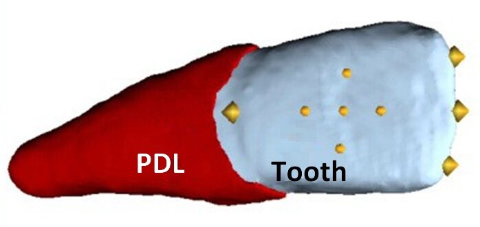 The tooth reconstructed from radiological data is embedded in the red-colored periodontal ligament (shown without the bone). The loads act on the points shown in the middle portion of the tooth crown as yellow spheres. (Image: University of Ulm)
