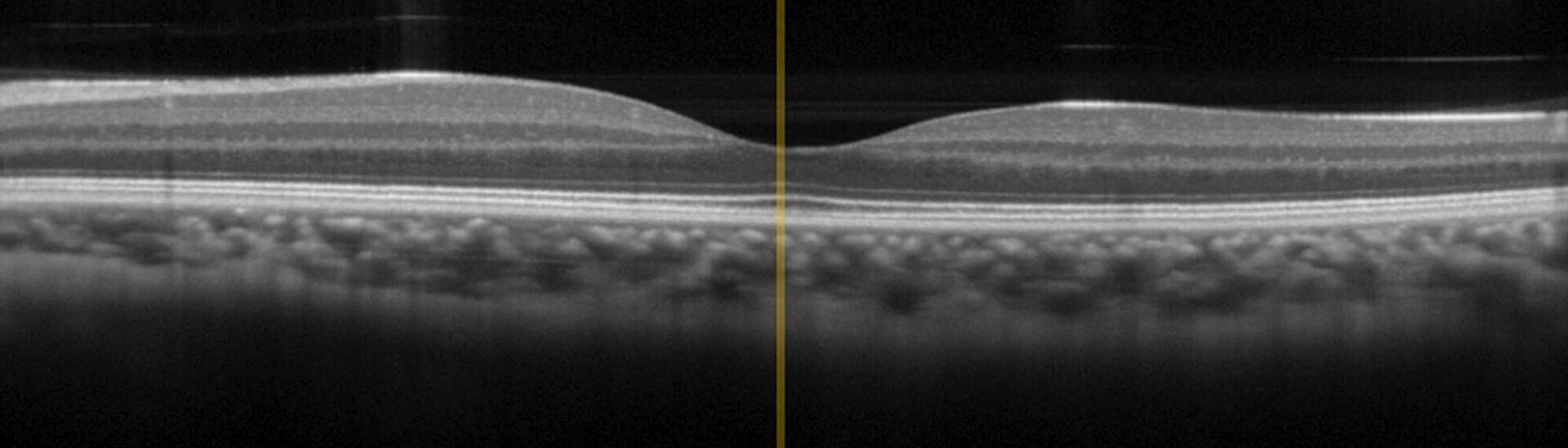 Physik Instrumente OCT Test Image